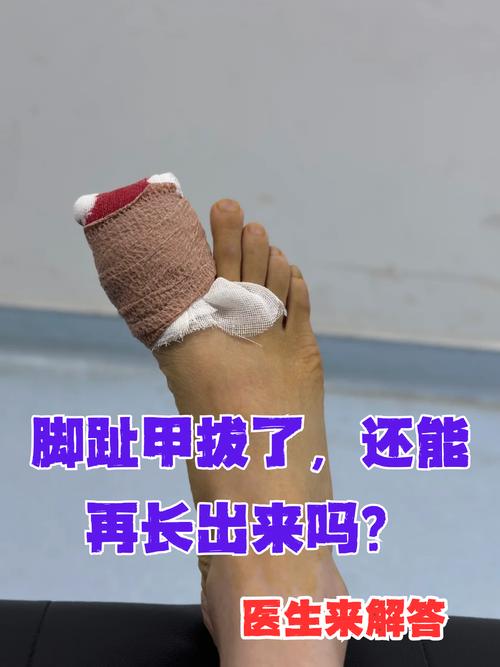 自己拔脚指甲有什么特别的预兆或周公解梦中的象征意义？