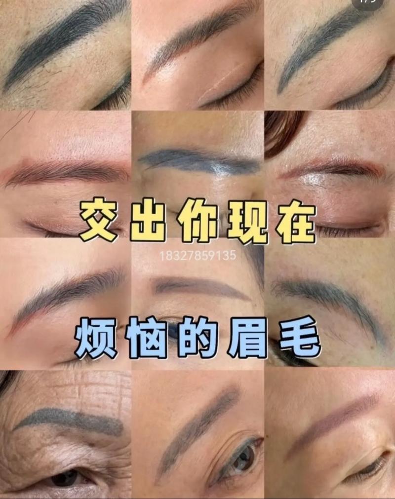 眉毛上有疤痕会影响命运吗？左眉疤意味着好运？