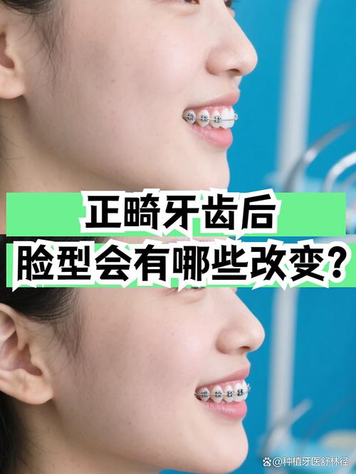牙齿矫正真的能改变一个人的命运吗？