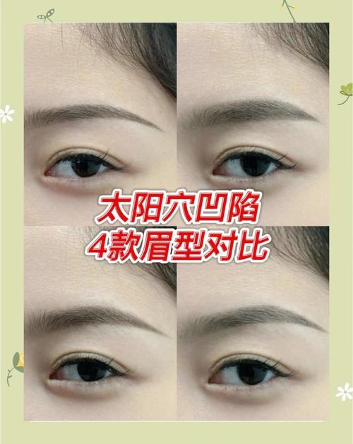 眉毛上方凹陷是代表什么面部特征？