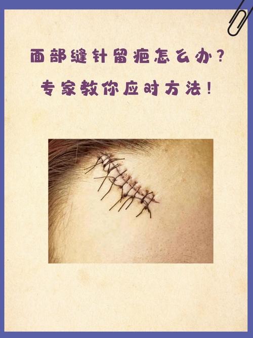 下巴缝针留下的疤痕对面相有何影响？