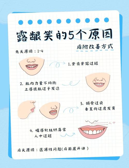 牙齿矫治会影响面相吗？女性笑露牙齿面相如何？