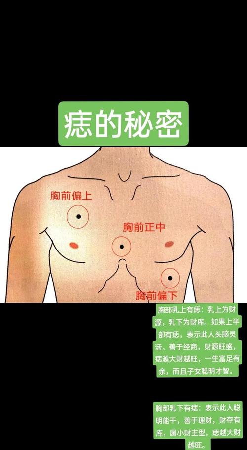 胸口长痣的位置与命运有何关联？