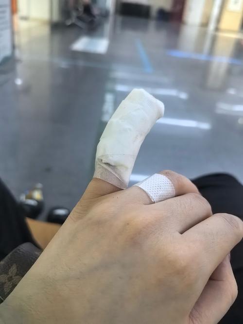 梦见胳膊被刀割出血，这预示着什么不祥的征兆？