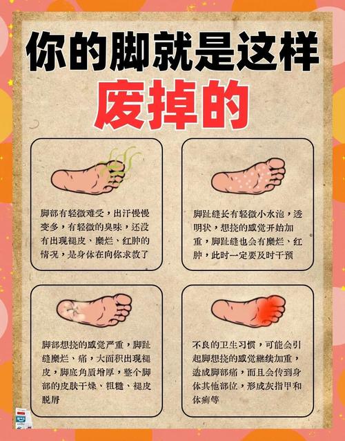 为什么有些人脚臭到让人难以忍受，命运似乎也因此受到影响？