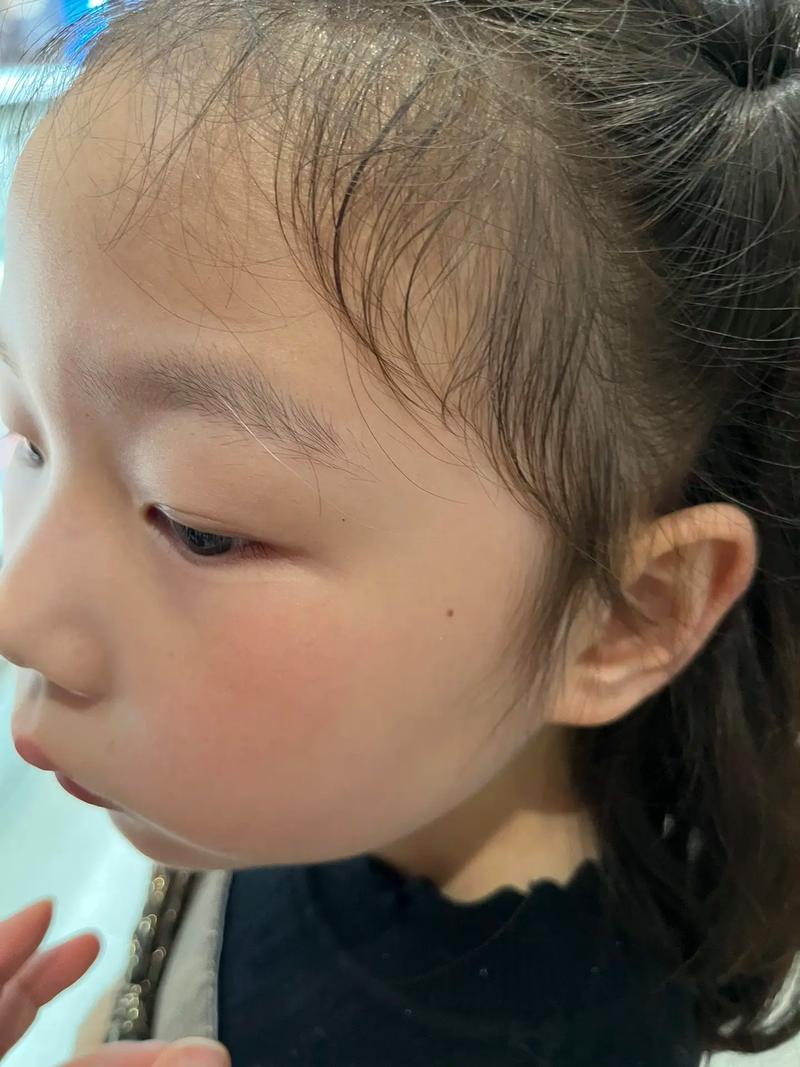 小孩眉毛长一根白眉毛，这是正常的吗？有什么影响？