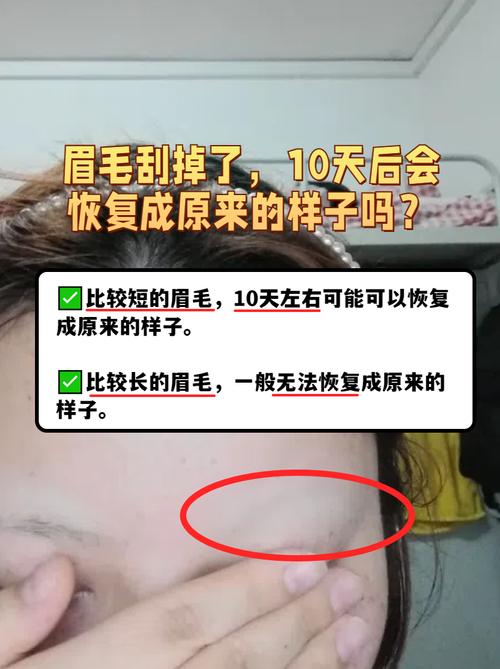眉毛刮秃了一块，怎么修复才嫩不留痕迹？