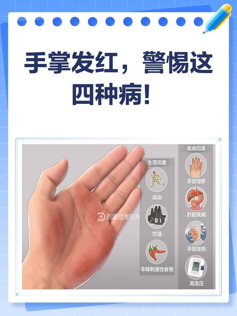 梦见手心受伤是什么征兆？预示着什么不好的事情？