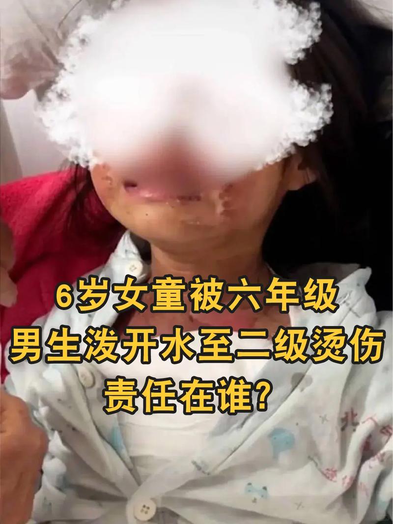 梦见孙女头部被烫伤，这预示着什么？是健康警告还是其他暗示？
