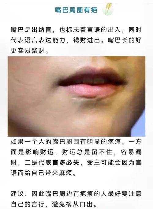 脸上有疤痕的人命运如何，是不是注定命苦？