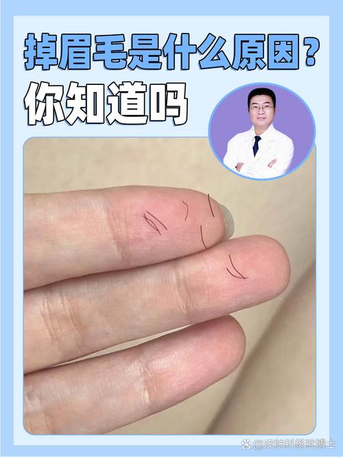 眉毛突然掉了一小块是什么原因导致的？