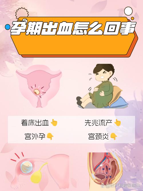 孕妇怀孕期间梦见来月经且出血量多，这是什么预兆？