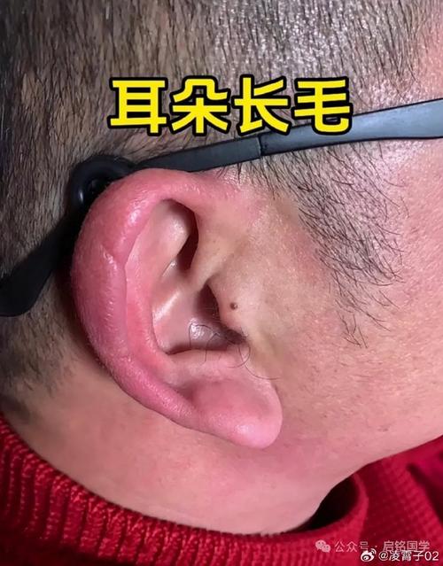 耳朵长毛是吉是凶，一根白毛预示着什么？