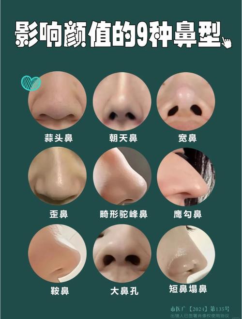 什么样的鼻子特征会导致运势逐渐衰败？