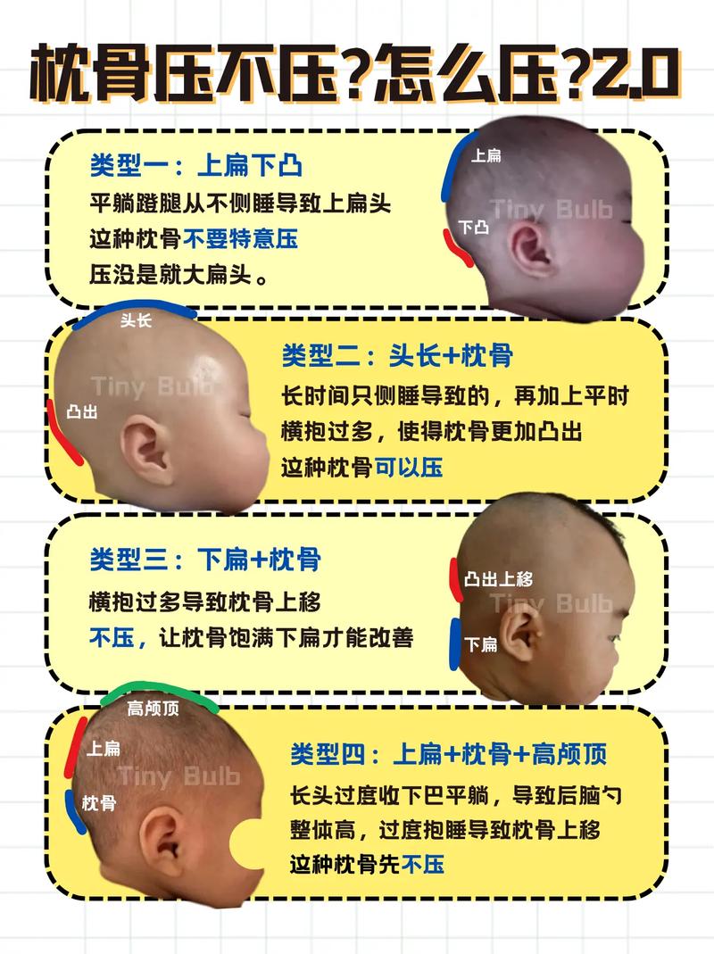 面相如何判断男性枕骨是否塌陷？