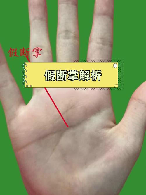 为什么假断掌在某种情况下被认为比真断掌更有优势？