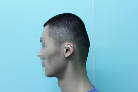 后脑勺平坦的人智商真的会比其他人低吗？