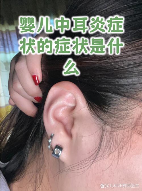 婴儿出生时耳朵上的小洞是耳垂耳洞吗？怎么回事？
