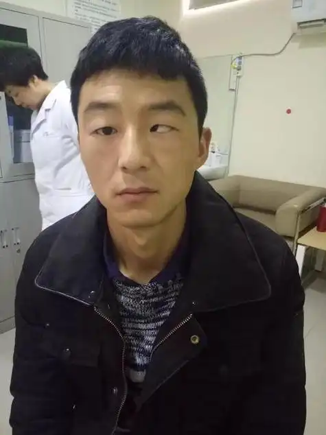 斜视面相的男人命运究竟如何？