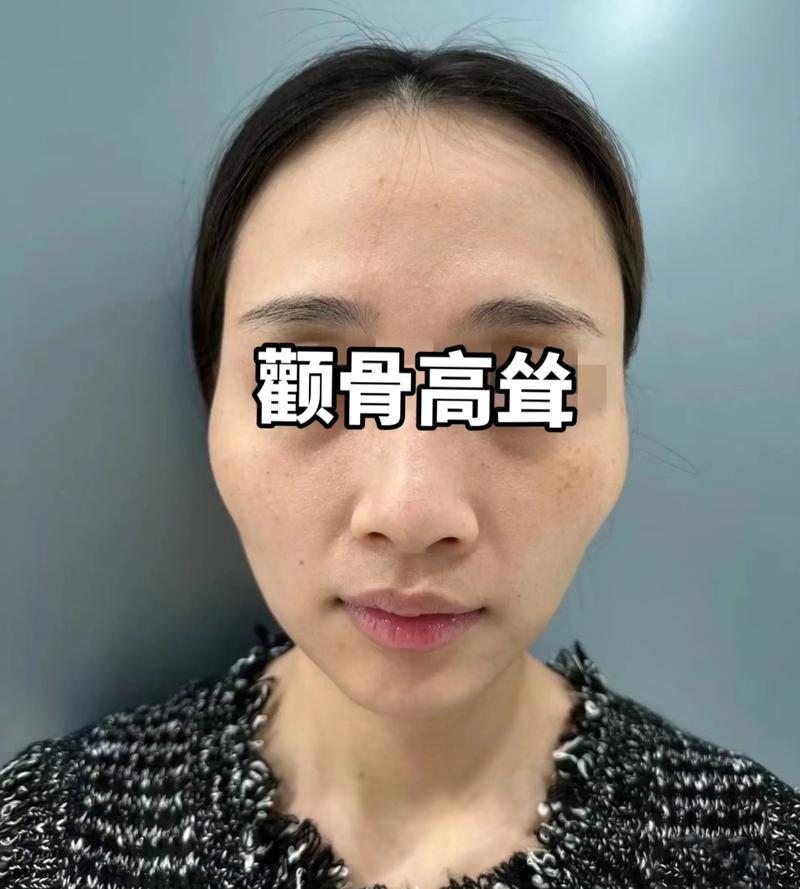 颧骨微凸面相是什么面相特征？