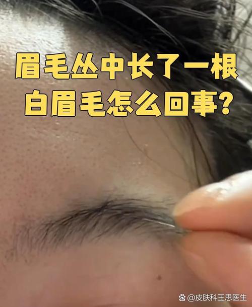眉毛里怎么会有根特别长且白色的毛发呢？