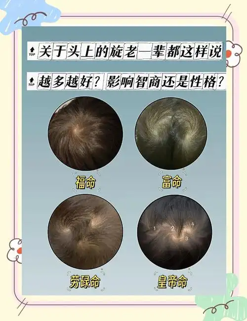 头顶双旋的人命运如何？这代表着什么特殊含义？