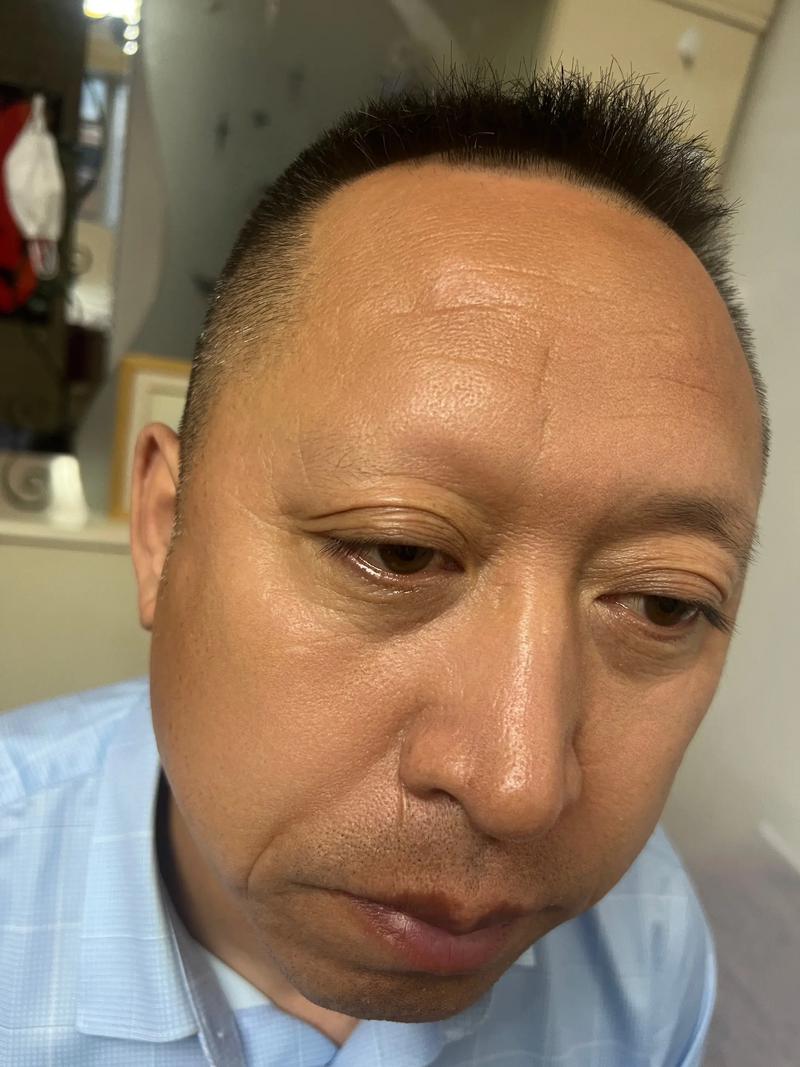 男生眉毛淡是不是说明胡须也少？