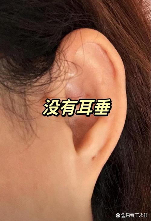 男人没有耳垂命运会否忒别？