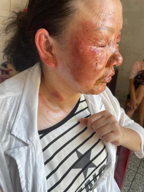梦见孙女头部被烫伤，这预示着什么？是健康警告还是其他暗示？