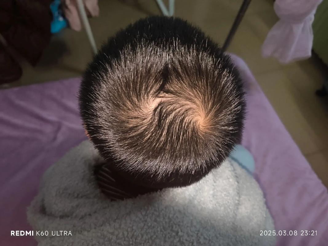 女孩头顶两个旋，风水上是否吉利？