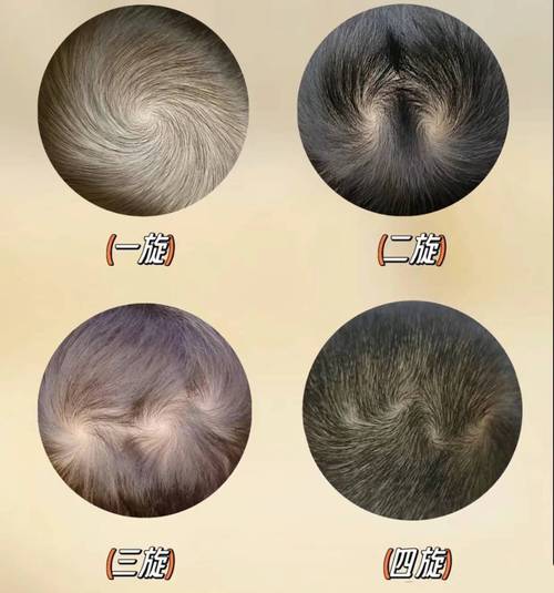 女孩头顶两个旋，风水上是否吉利？