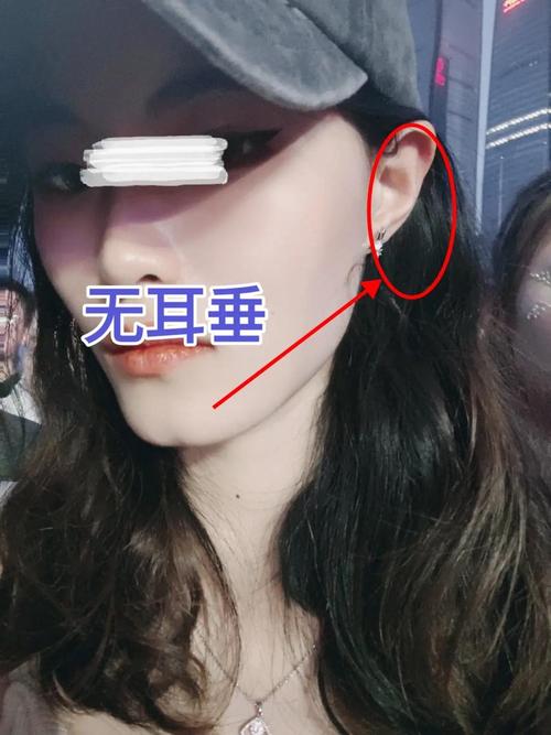 耳垂缺一块或无耳垂的人命运如何，会否影响一生运势？