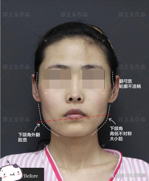 下颌骨凸起面相好堪吗？凸面相有哪些优点？