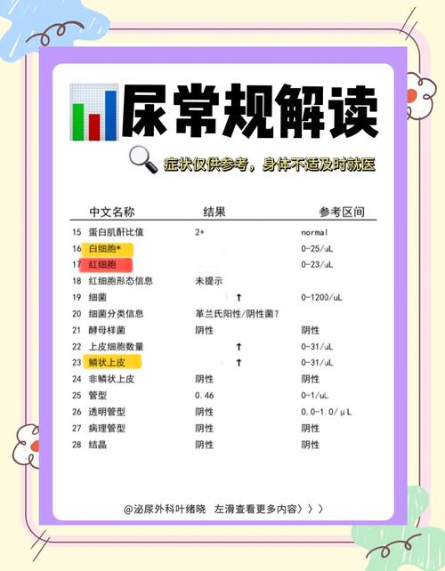 梦见自己尿检是什么征兆，周公解梦有何说法？