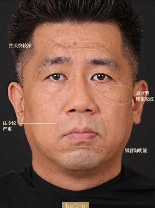 什么样的男人面相有凤尾纹和罗网纹，算得上是凤尾纹面相男人？