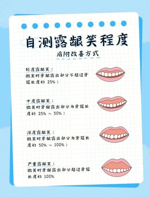 牙齿矫治会影响面相吗？女性笑露牙齿面相如何？