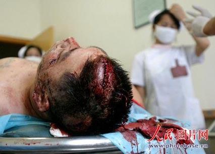 梦见自己砍别人头是什么预兆或象征？