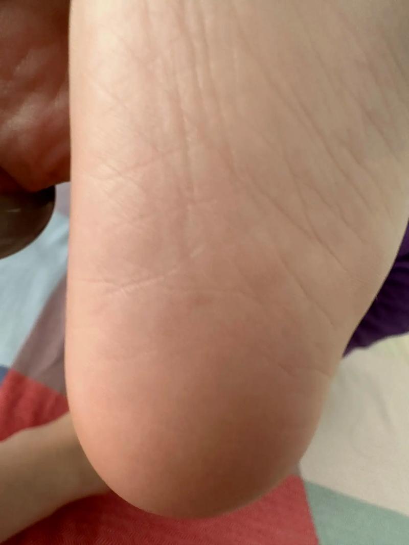 民间惯与脚板底胎记的命运有哪些古老的传说或说法？