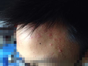 2. 额头之痣：祖业与福禄双重象征