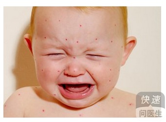 3.1 辛辣刺激性食物的影响机制