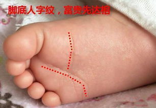 1.1 足底宽阔可容龟者之形态描述