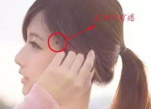 三、 胸口左右两侧痣对人格特质差异化的阐释