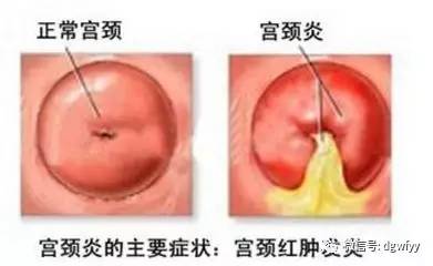 三、 泌尿系统—水与电的不平衡