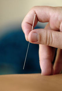 针灸大夫八字特征有哪些？国家公认十大针灸流派是哪些？