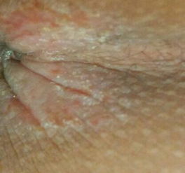 四、 过敏反应：个体敏感性的复杂性