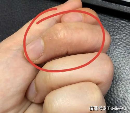 4. 长而粗的大拇指：意志力与领导权威的坚实基石