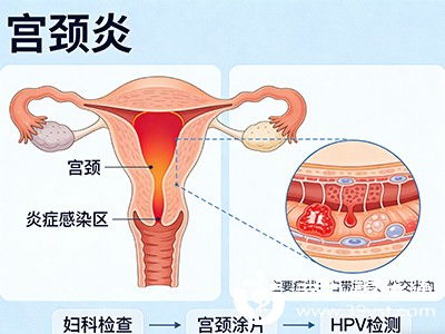 一、月经后持续出血的常见原因