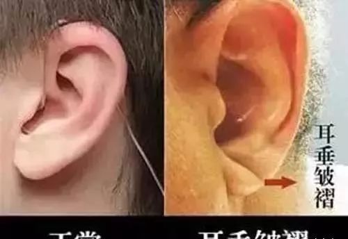 小耳朵的特征及其对运势的影响