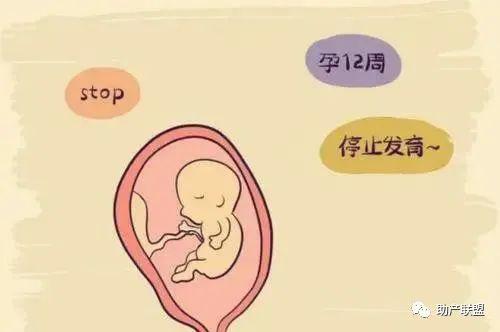 胚胎停育的症状