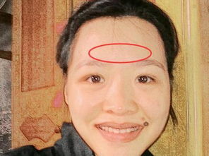 七、 肤色苍白或黄染——贫血与免疫力下降